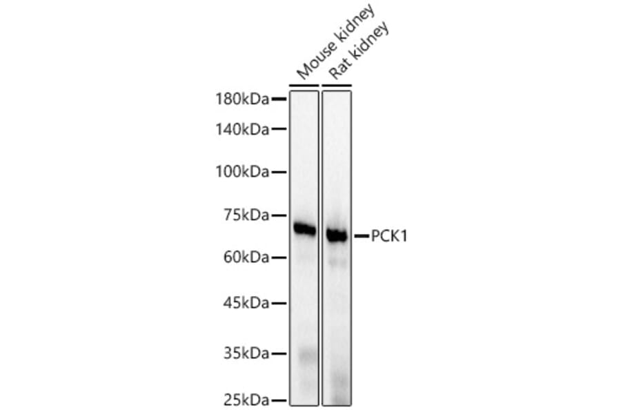 Western Blot - Anti-PCK1/PEPC Antibody [ARC56074] (A306044) - Antibodies.com