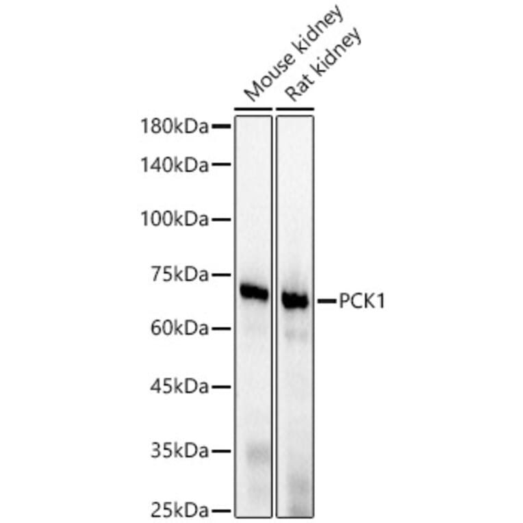 Western Blot - Anti-PCK1/PEPC Antibody [ARC56074] (A306044) - Antibodies.com