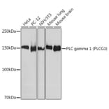 Western Blot - Anti-Phospholipase C gamma 1/PLC-gamma-1 Antibody [ARC1345] (A306045) - Antibodies.com