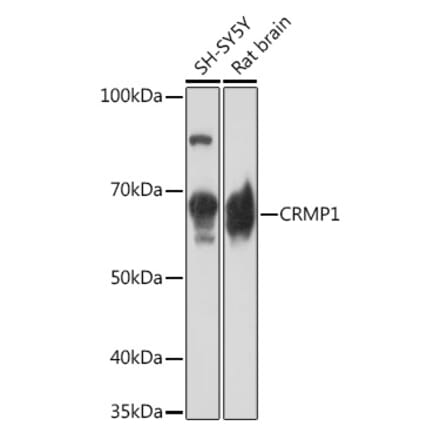 Western Blot - Anti-CRMP1 Antibody [ARC1918] (A306048) - Antibodies.com