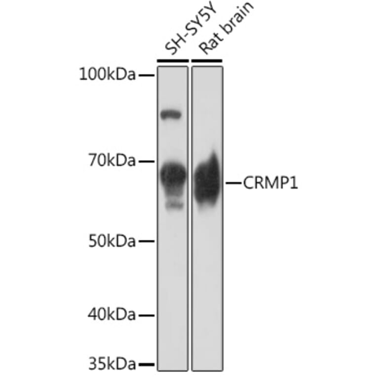 Western Blot - Anti-CRMP1 Antibody [ARC1918] (A306048) - Antibodies.com