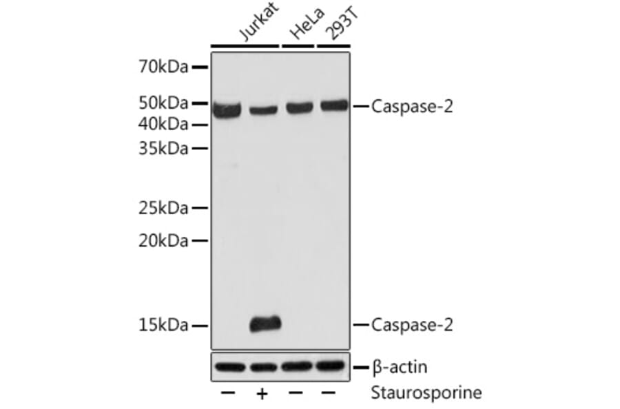 Western Blot - Anti-Caspase-2 Antibody [ARC0317] (A306049) - Antibodies.com