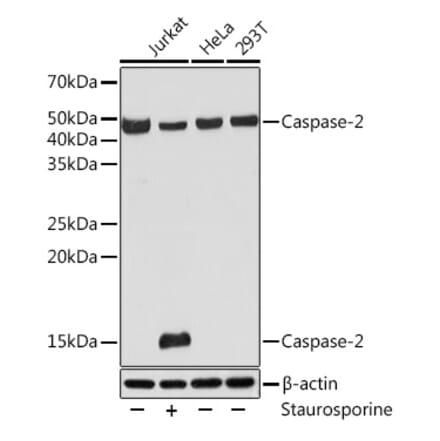 Western Blot - Anti-Caspase-2 Antibody [ARC0317] (A306049) - Antibodies.com
