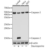 Western Blot - Anti-Caspase-2 Antibody [ARC0317] (A306049) - Antibodies.com