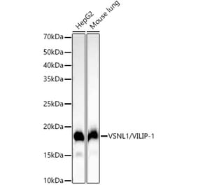 Western Blot - Anti-VILIP1 Antibody [ARC54754] (A306055) - Antibodies.com