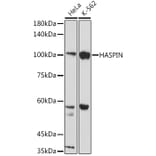Western Blot - Anti-Haspin Antibody (A306056) - Antibodies.com