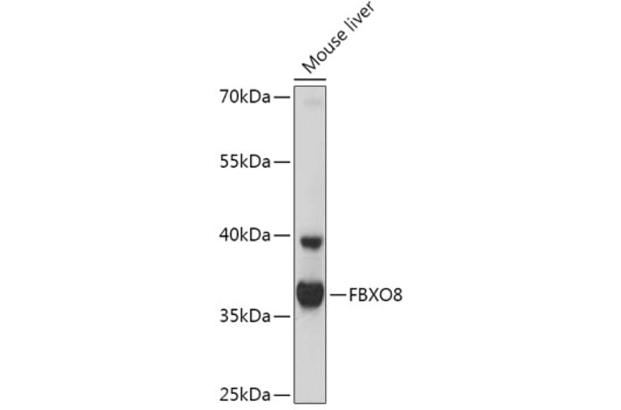 Western Blot - Anti-FBXO8/FBS Antibody (A306058) - Antibodies.com