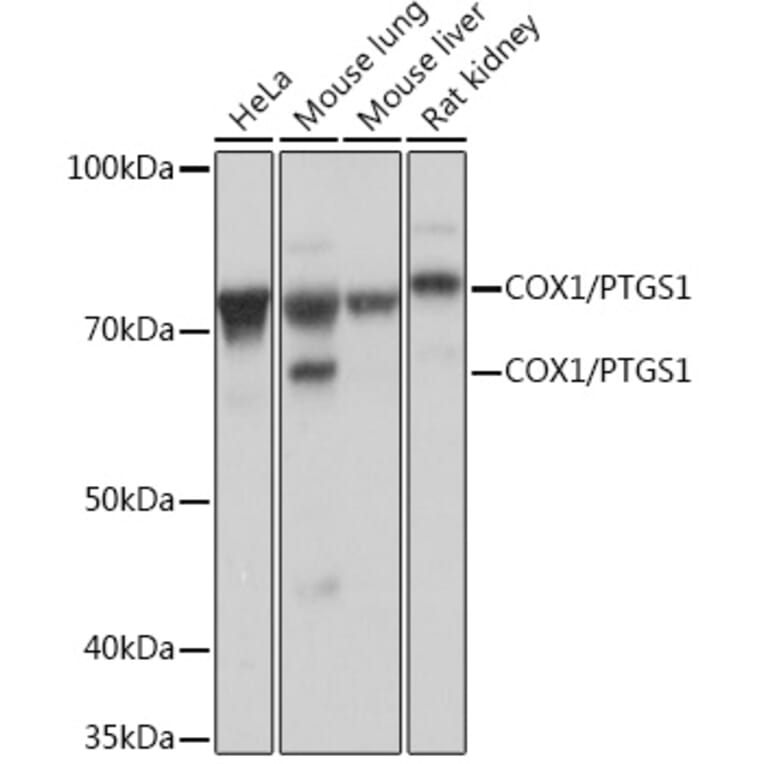 Western Blot - Anti-COX1/Cyclooxygenase 1 Antibody [ARC0960] (A306059) - Antibodies.com
