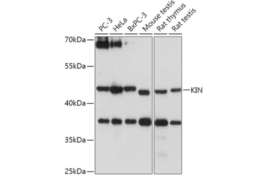 Western Blot - Anti-KIN Antibody (A306061) - Antibodies.com