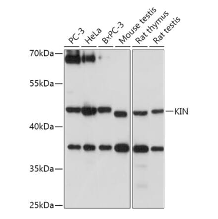 Western Blot - Anti-KIN Antibody (A306061) - Antibodies.com