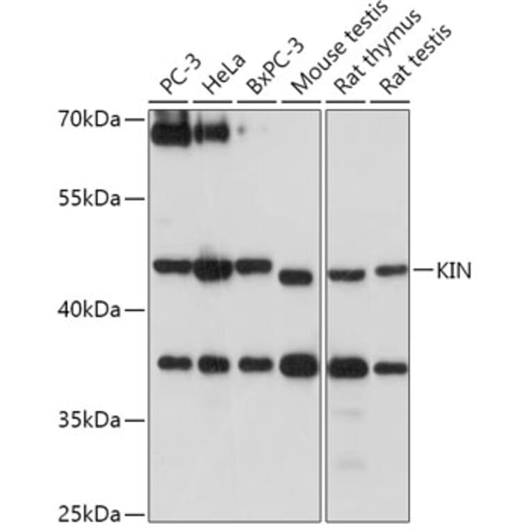 Western Blot - Anti-KIN Antibody (A306061) - Antibodies.com