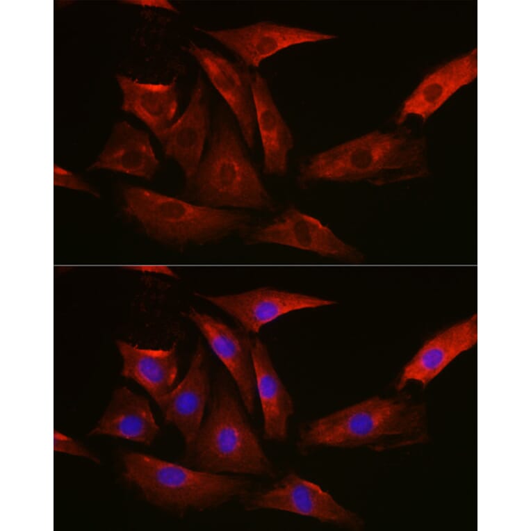 Immunofluorescence - Anti-Thymidylate Synthase Antibody (A306063) - Antibodies.com