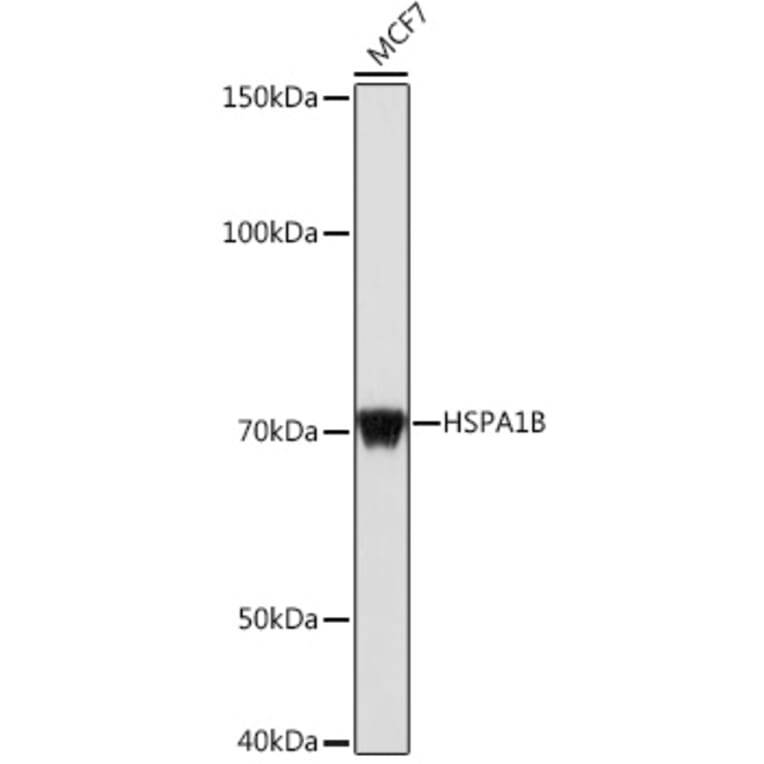 Western Blot - Anti-HSP70 Antibody (A306064) - Antibodies.com