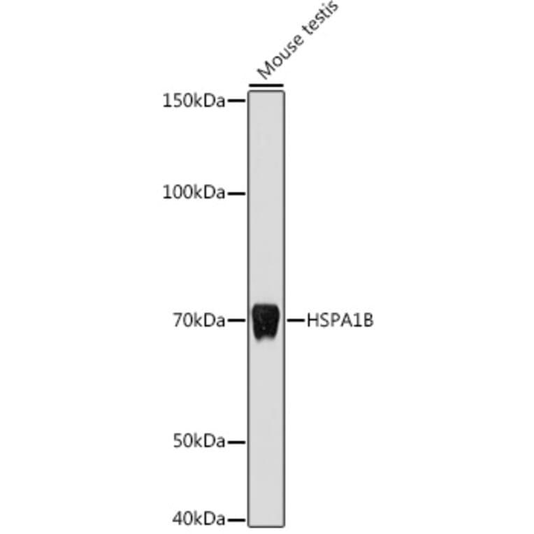 Western Blot - Anti-HSP70 Antibody (A306064) - Antibodies.com