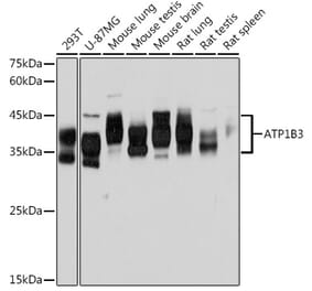 Western Blot - Anti-ATP1B3 Antibody [ARC2205] (A306065) - Antibodies.com
