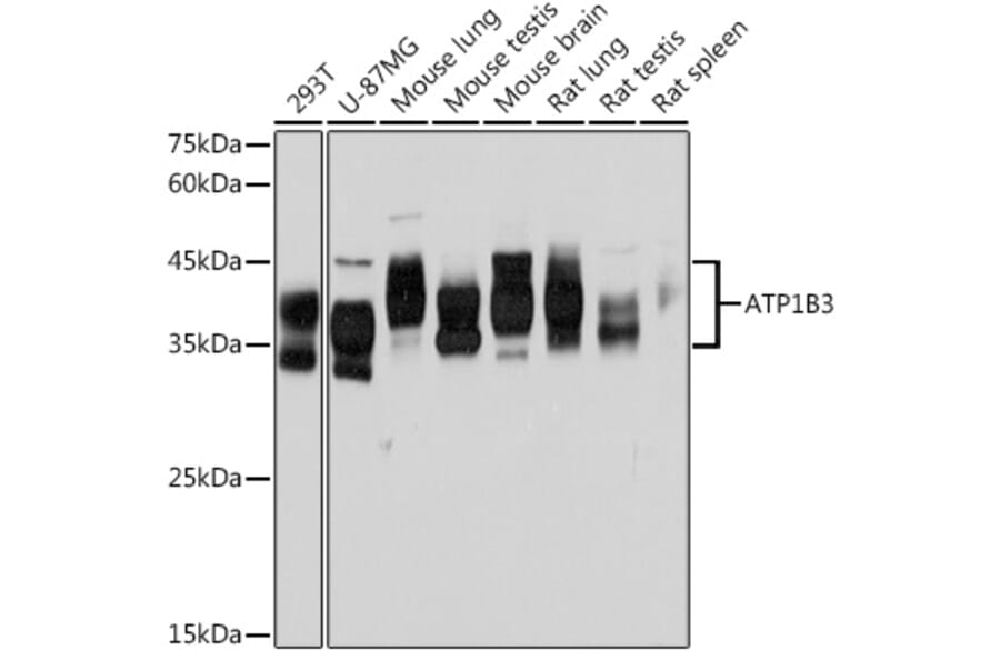 Western Blot - Anti-ATP1B3 Antibody [ARC2205] (A306065) - Antibodies.com