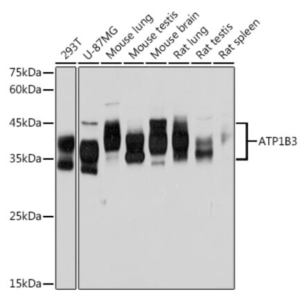 Western Blot - Anti-ATP1B3 Antibody [ARC2205] (A306065) - Antibodies.com