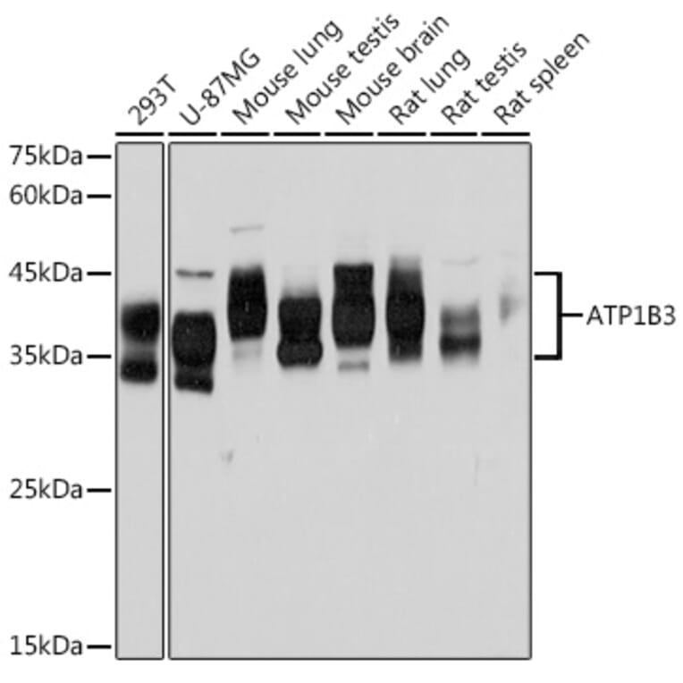 Western Blot - Anti-ATP1B3 Antibody [ARC2205] (A306065) - Antibodies.com