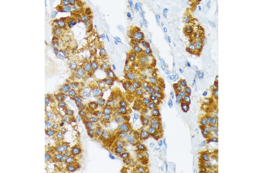 Immunohistochemistry - Anti-ATP1B3 Antibody [ARC2205] (A306065) - Antibodies.com