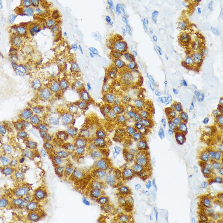 Immunohistochemistry - Anti-ATP1B3 Antibody [ARC2205] (A306065) - Antibodies.com
