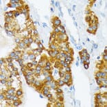 Immunohistochemistry - Anti-ATP1B3 Antibody [ARC2205] (A306065) - Antibodies.com
