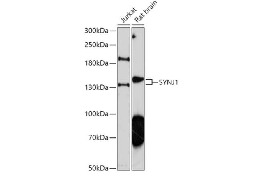 Western Blot - Anti-Synaptojanin Antibody (A306066) - Antibodies.com