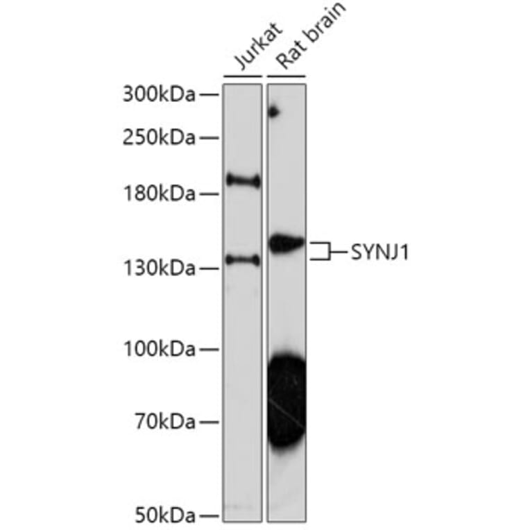 Western Blot - Anti-Synaptojanin Antibody (A306066) - Antibodies.com