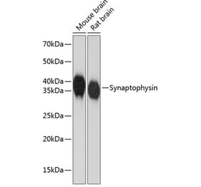 Western Blot - Anti-Synaptophysin Antibody [ARC0427] (A306067) - Antibodies.com