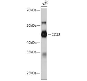 Western Blot - Anti-CD23 Antibody [ARC0596] (A306068) - Antibodies.com