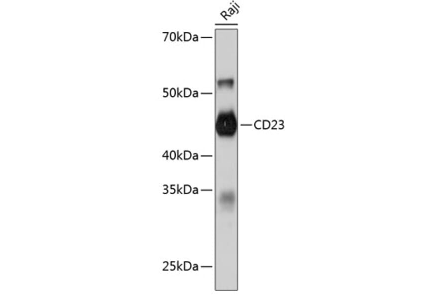 Western Blot - Anti-CD23 Antibody [ARC0596] (A306068) - Antibodies.com