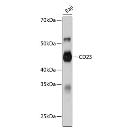 Western Blot - Anti-CD23 Antibody [ARC0596] (A306068) - Antibodies.com