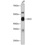 Western Blot - Anti-CD23 Antibody [ARC0596] (A306068) - Antibodies.com