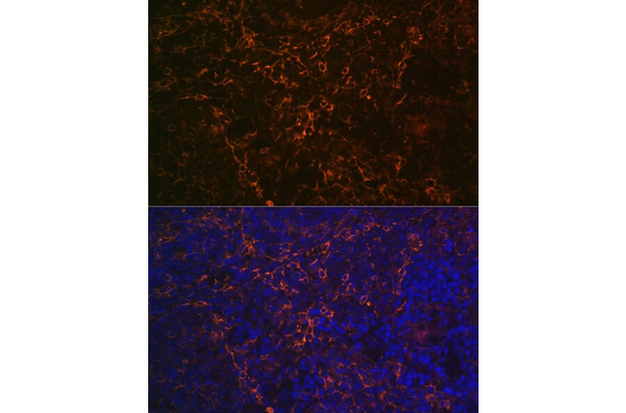Immunofluorescence - Anti-CD23 Antibody [ARC0596] (A306068) - Antibodies.com