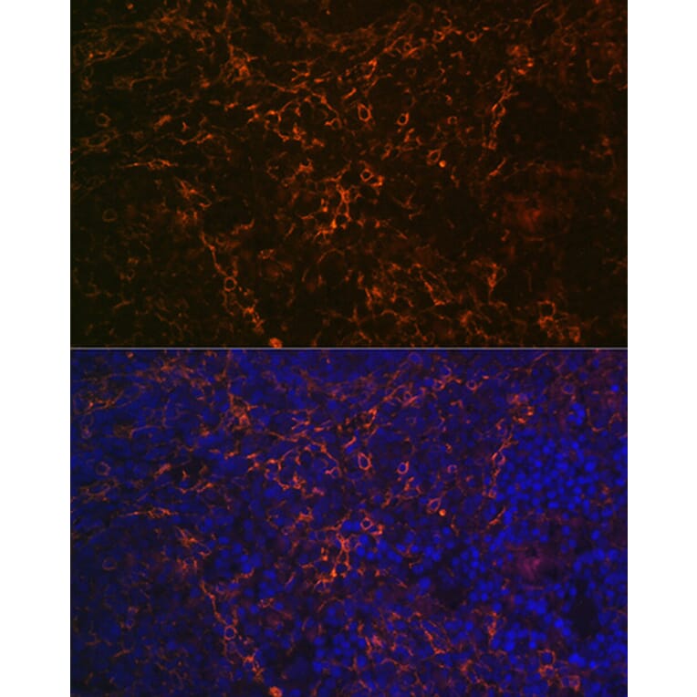 Immunofluorescence - Anti-CD23 Antibody [ARC0596] (A306068) - Antibodies.com