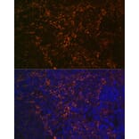 Immunofluorescence - Anti-CD23 Antibody [ARC0596] (A306068) - Antibodies.com