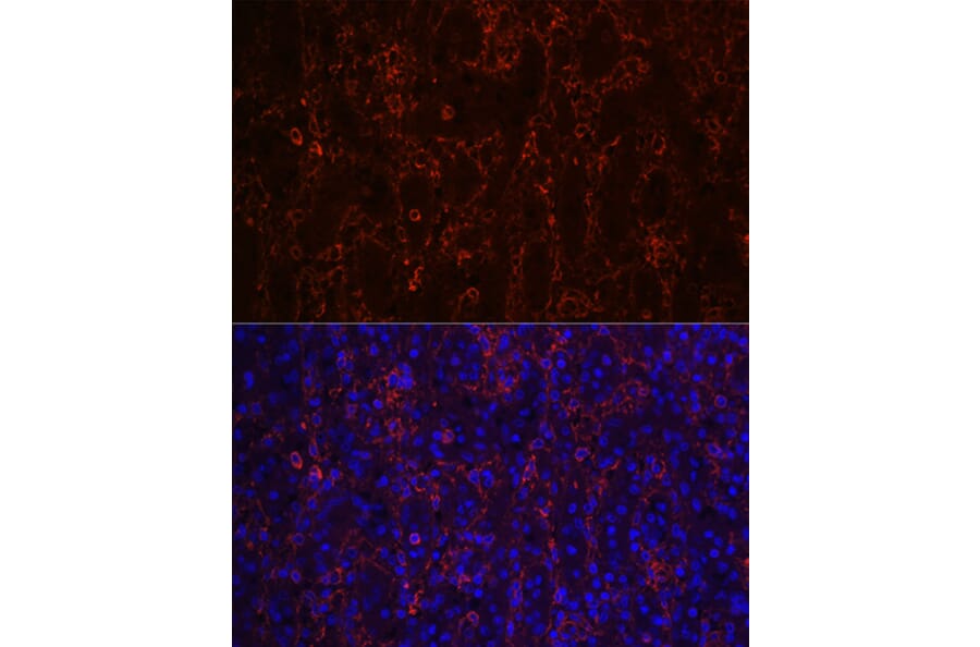 Immunofluorescence - Anti-CD23 Antibody [ARC0596] (A306068) - Antibodies.com