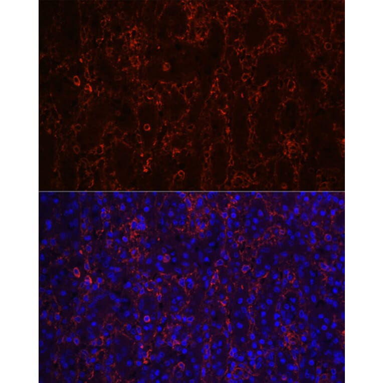 Immunofluorescence - Anti-CD23 Antibody [ARC0596] (A306068) - Antibodies.com