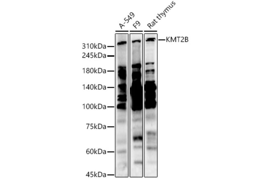 Western Blot - Anti-KMT2B/MLL4 Antibody (A306069) - Antibodies.com