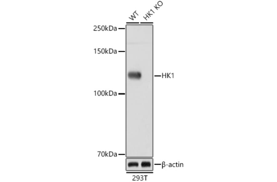 Western Blot - Anti-Hexokinase 1 Antibody [ARC0256] (A306070) - Antibodies.com