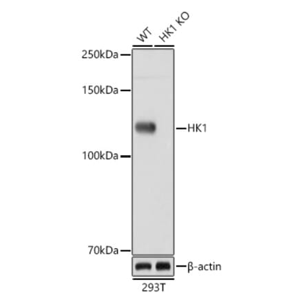 Western Blot - Anti-Hexokinase 1 Antibody [ARC0256] (A306070) - Antibodies.com