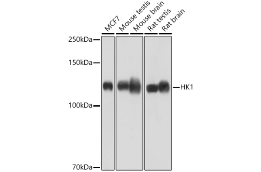 Western Blot - Anti-Hexokinase 1 Antibody [ARC0256] (A306070) - Antibodies.com