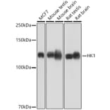 Western Blot - Anti-Hexokinase 1 Antibody [ARC0256] (A306070) - Antibodies.com