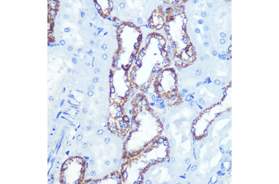 Immunohistochemistry - Anti-Hexokinase 1 Antibody [ARC0256] (A306070) - Antibodies.com