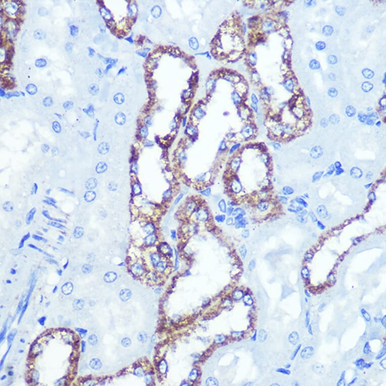 Immunohistochemistry - Anti-Hexokinase 1 Antibody [ARC0256] (A306070) - Antibodies.com