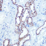 Immunohistochemistry - Anti-Hexokinase 1 Antibody [ARC0256] (A306070) - Antibodies.com