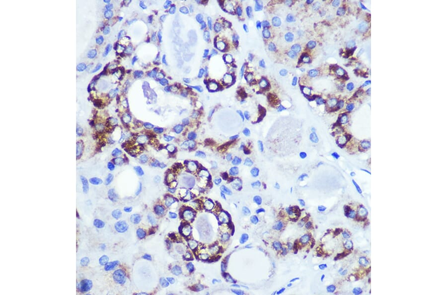 Immunohistochemistry - Anti-Hexokinase 1 Antibody [ARC0256] (A306070) - Antibodies.com