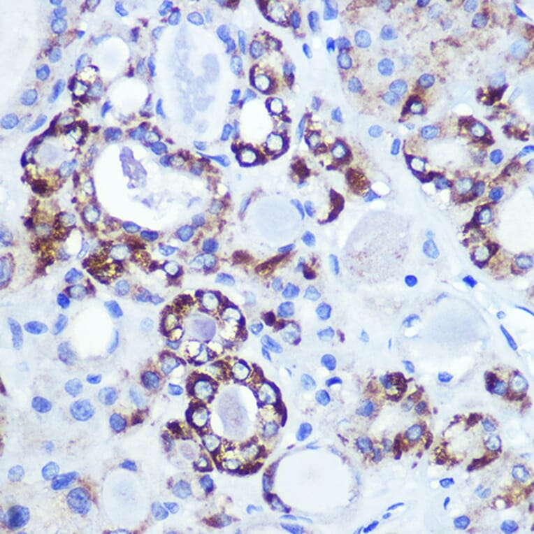 Immunohistochemistry - Anti-Hexokinase 1 Antibody [ARC0256] (A306070) - Antibodies.com