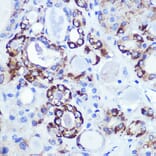 Immunohistochemistry - Anti-Hexokinase 1 Antibody [ARC0256] (A306070) - Antibodies.com