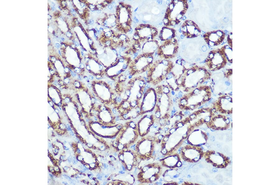 Immunohistochemistry - Anti-Hexokinase 1 Antibody [ARC0256] (A306070) - Antibodies.com