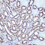 Immunohistochemistry - Anti-Hexokinase 1 Antibody [ARC0256] (A306070) - Antibodies.com